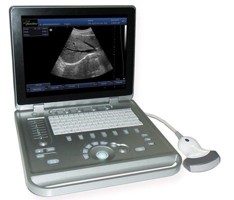 Medical Electronic Ultrasound Machine AG-BU009(Including Convex transducer probe)