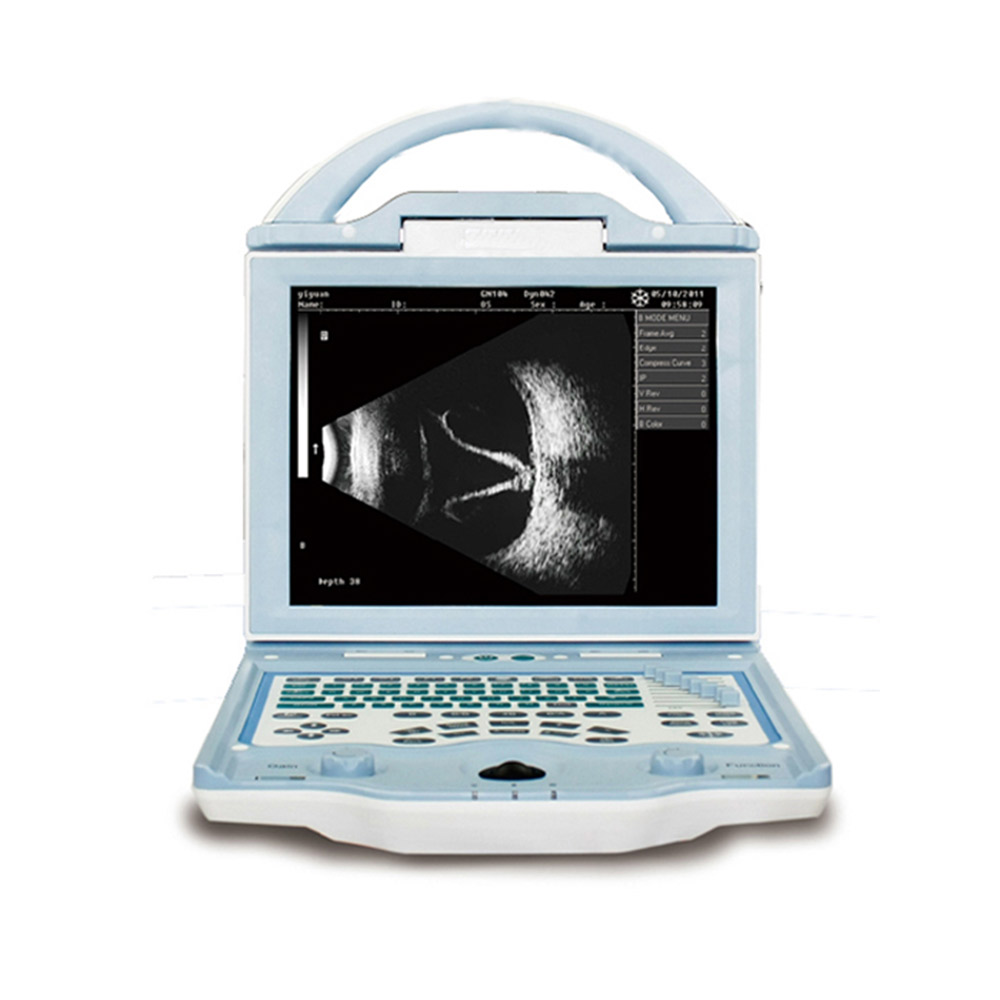 Ophthalmological Ultrasound Scanner with A/B Mode CAS-2000C​