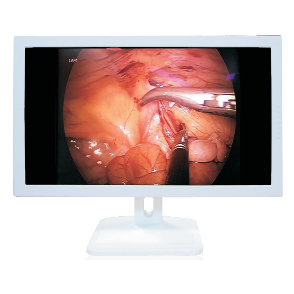 LC-MS21501 21.5-Inch Endoscopic Medical Monitor