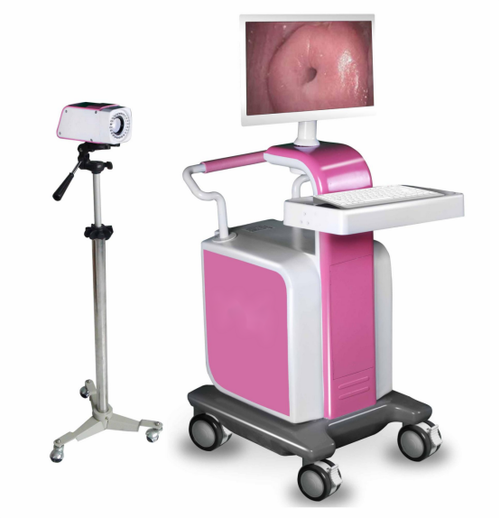 DigitalVideoColposcope