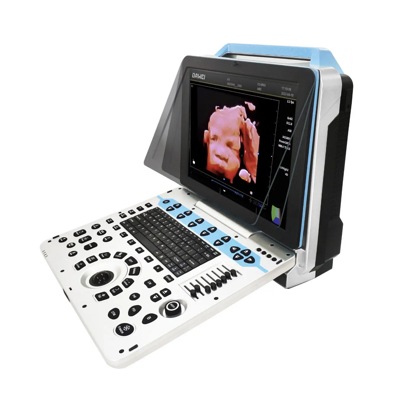 Portable 4D color doppler DW-P30
