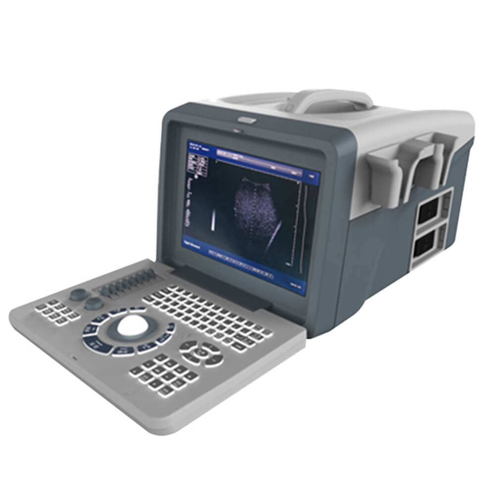 Digital LED Portable Diagnostic Ultrasound Machine MYXF-218