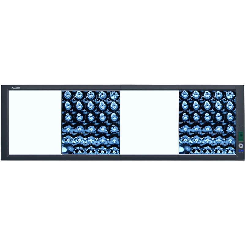 ZG-4 Super Bright LED Quadruple View Film Viewer