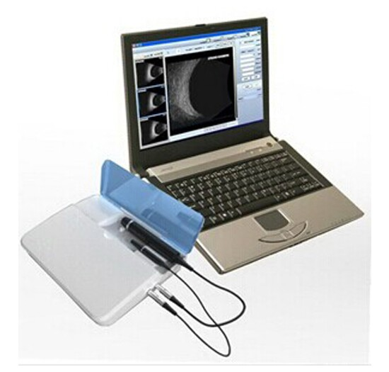 AG-BU006 Hospital Ophthalmology Ultrasound Machine