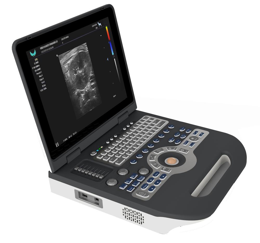 Full Digital Color Doppler Ultrasound Machine MYXF-3800