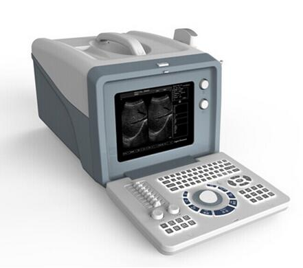 AG-BU00P Medical Electronic Portable Ultrasound Scanner