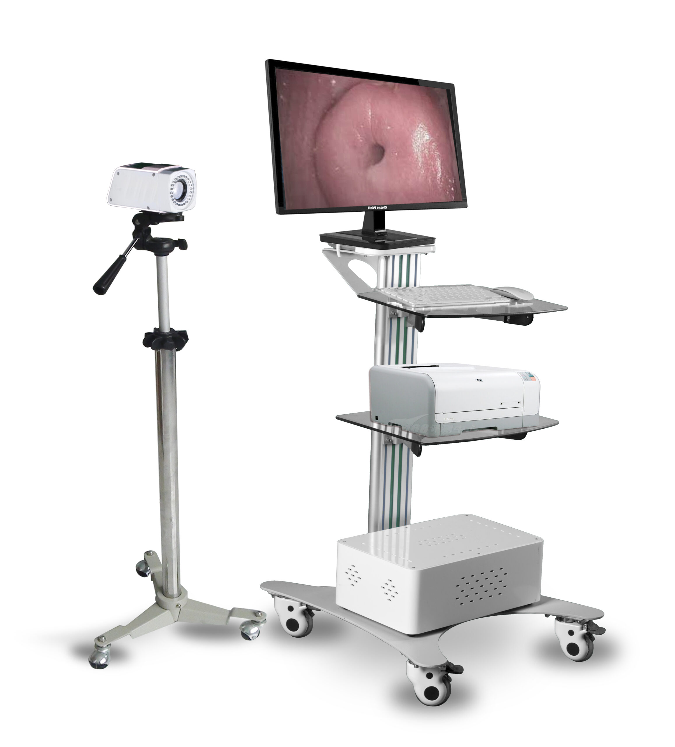 Digital Video Colposcope
