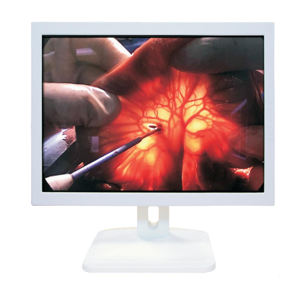 LC-MS19002 19-Inch Endoscopic Medical Monitor