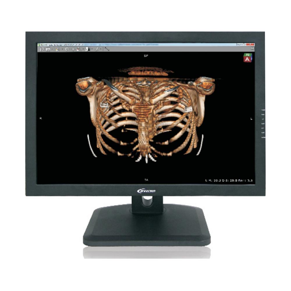 LC-MS27002 27" 4M Colorful Monitor