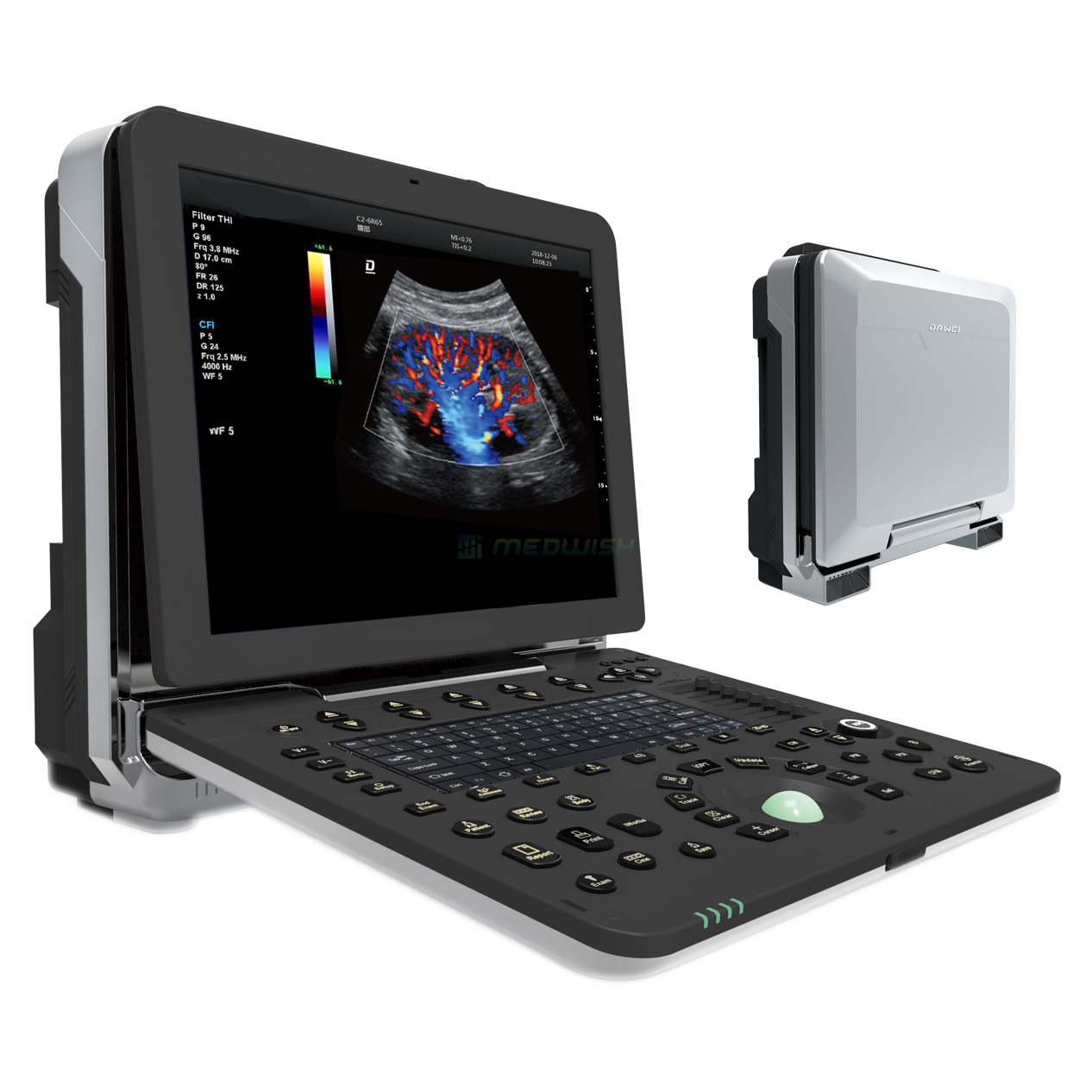 4D Portable Robust Cardiovascular Ultrasound Equipment DW-P8