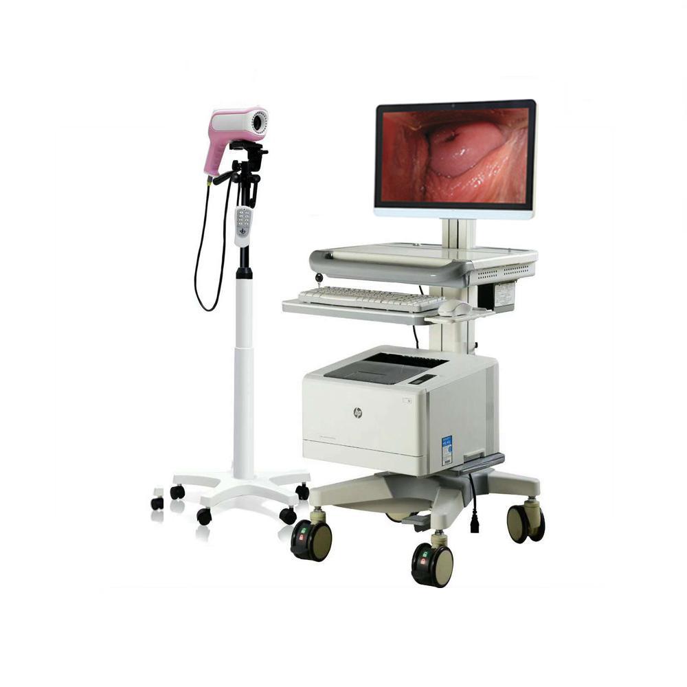 Digital Electronic Colposcope XZLC-002