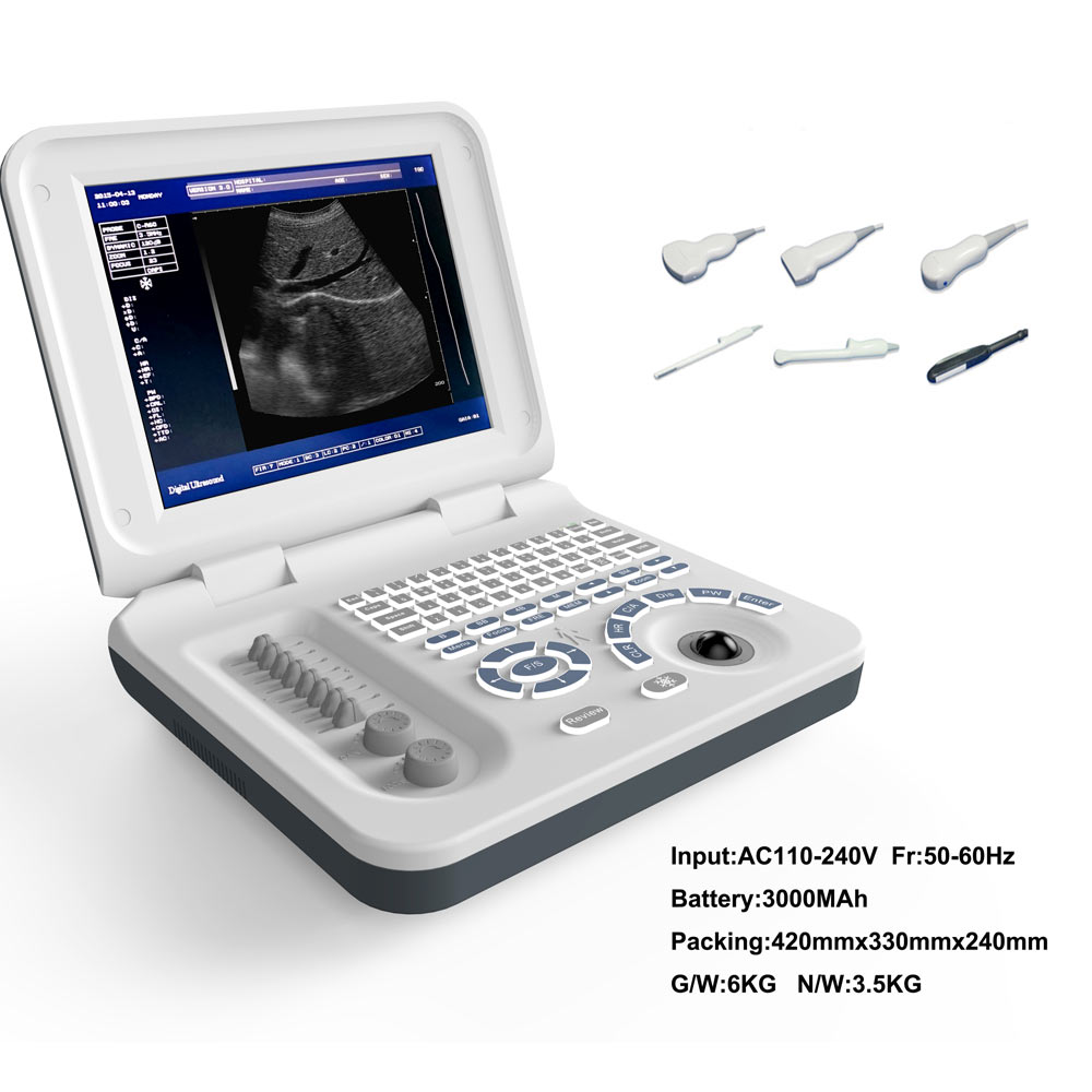 Full Digital LED Laptop Ultrasound Machine MYXF-S30