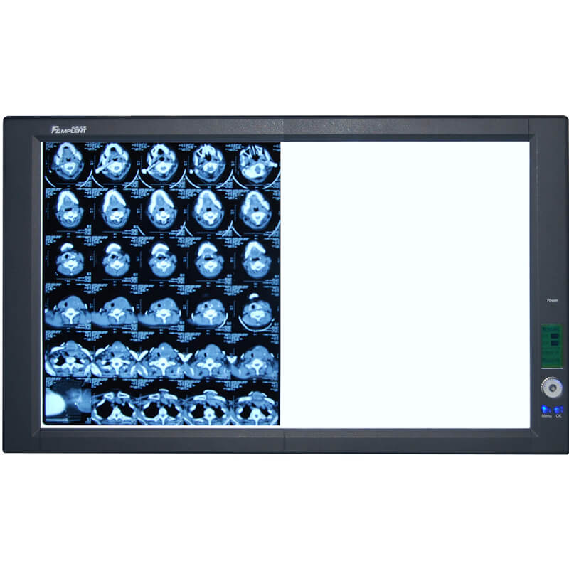 ZG-2 Super Bright LED Dual View Film Viewer