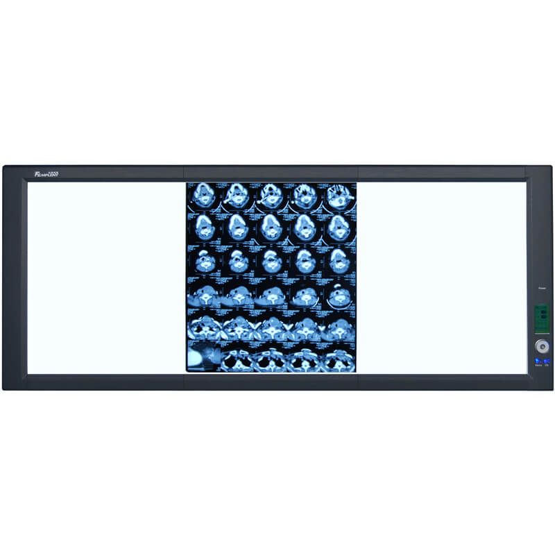 ZG-3 Super Bright LED Triple View Film Viewer